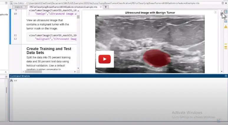 Breast Tumor Classification from Ultrasound Images Using Fuzzy Inference in MATLAB