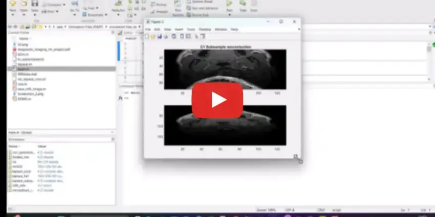 Image Reconstruction for Magnetic Resonance Imaging using MATLAB